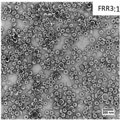TEM images of obtained liposomes