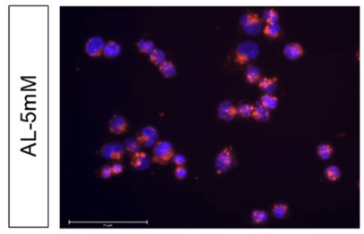Fluorescence microscopy of A2780 with liposomes labeled with rhodamine B
