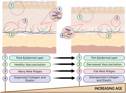 Scheme of Histological changes in skin depending on the age