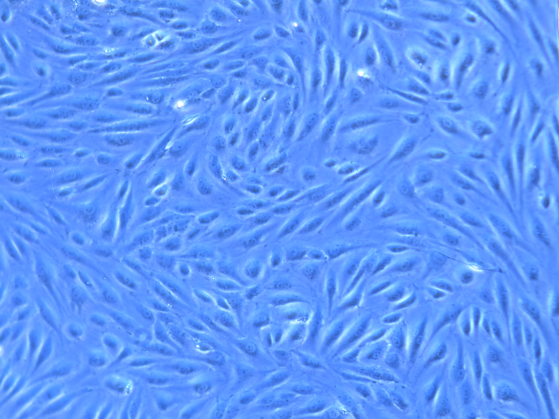 Endothelial Cell Culture Under Shear Stress Using Omi - Fluigent