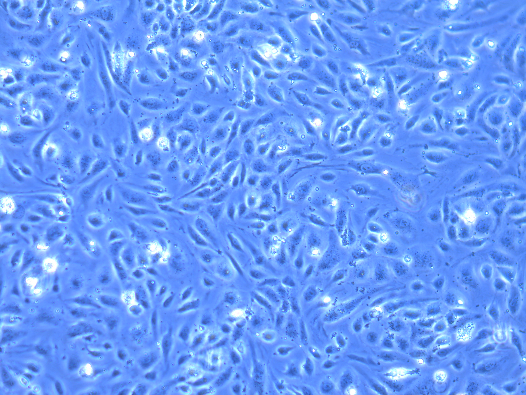 HUVEC cells before connexion to Omi